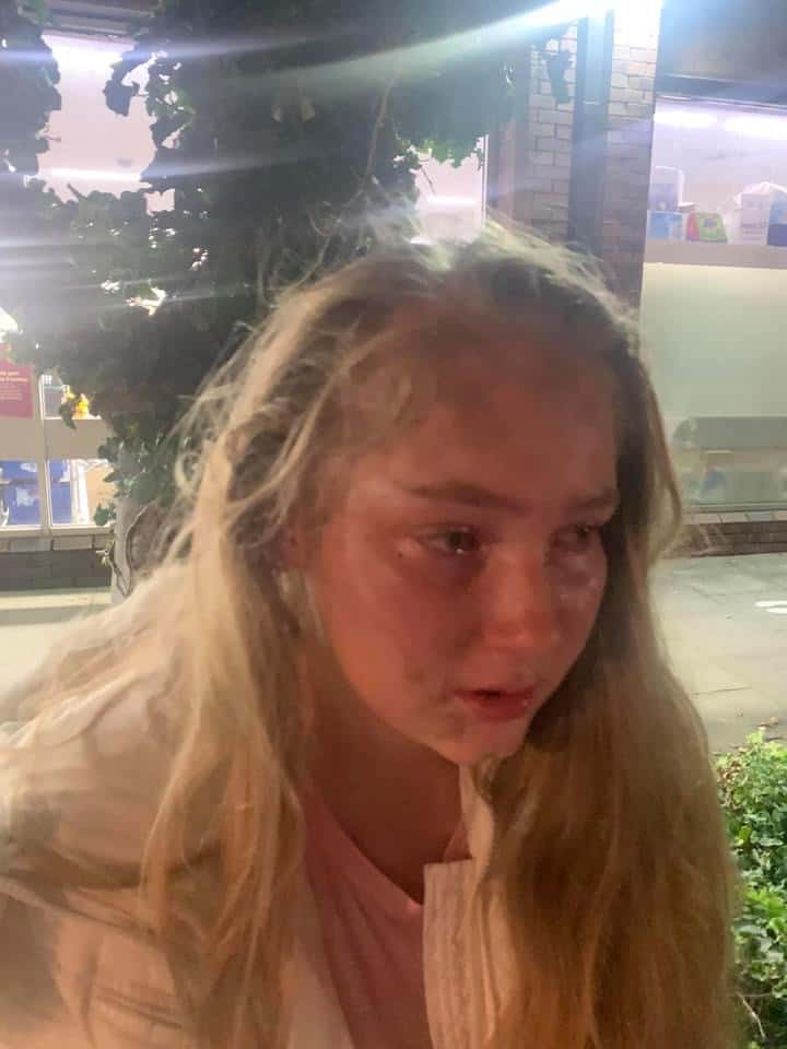 16 Year Old Girl Savagely Attacked St Annes Square Las